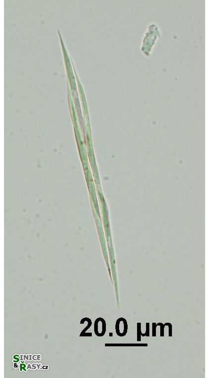 Monoraphidium griffithii