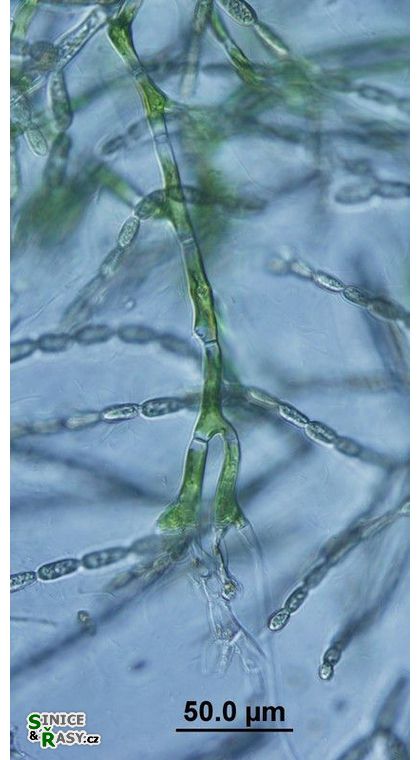 Aphanochaete sp. 
