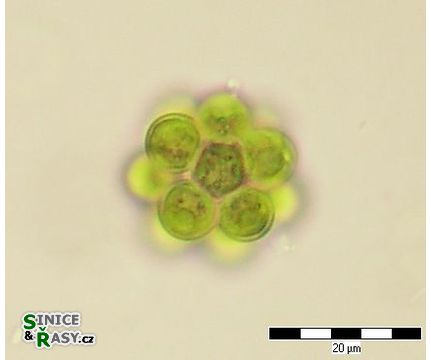 Coelastrum microporum