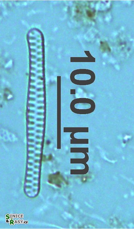 Staurosirella berolinensis