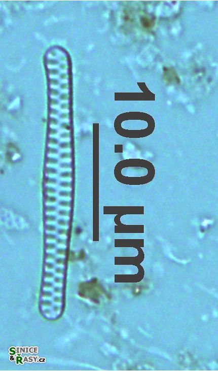 Staurosirella berolinensis