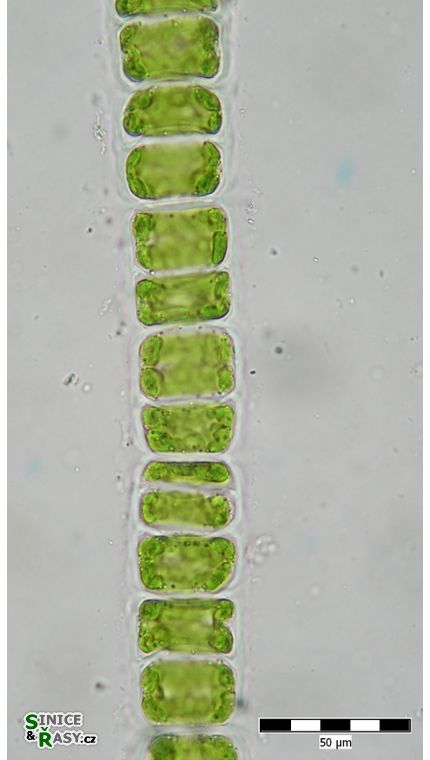 Ulothrix zonata