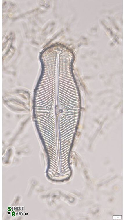 Didymosphenia geminata