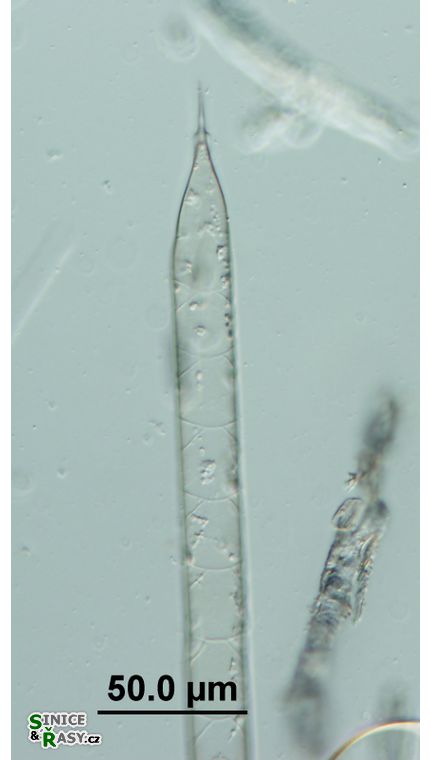 Rhizosolenia hebetata f. semispina
