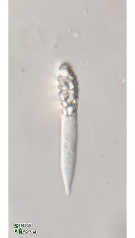 Astasia praecompleta