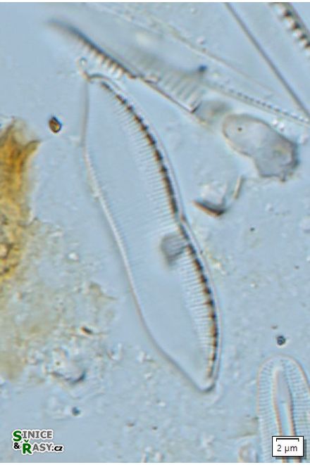 Nitzschia umbonata