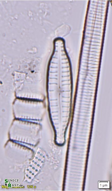 Gomphonema protractum