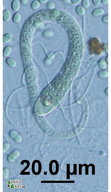 Calothrix sp.