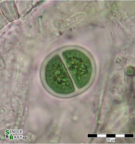 Chroococcus turgidus