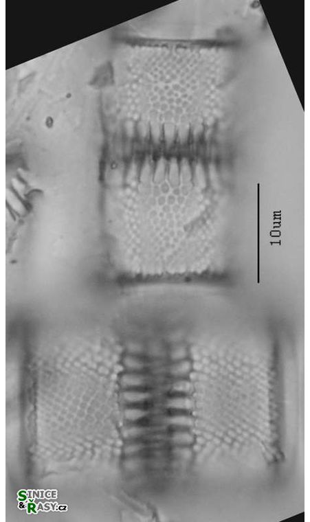 Aulacoseira valida