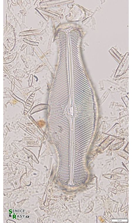 Didymosphenia geminata