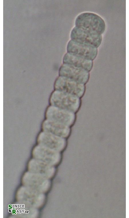Planktothrix planctonica