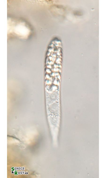 Astasia praecompleta