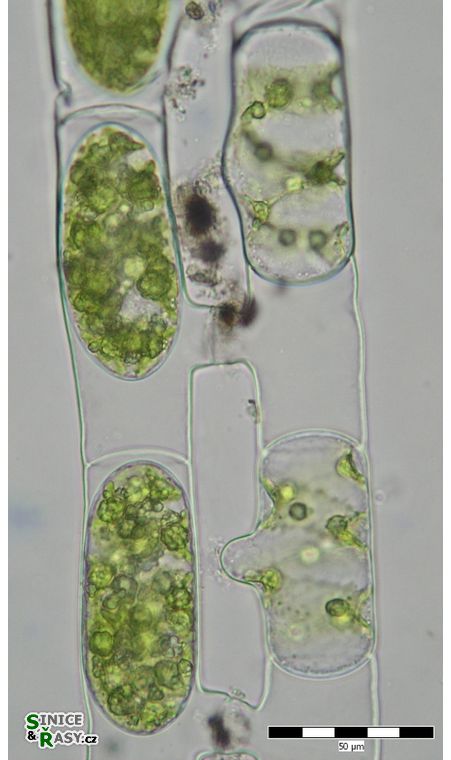 Spirogyra