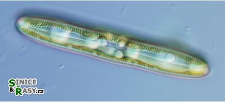 Pinnularia