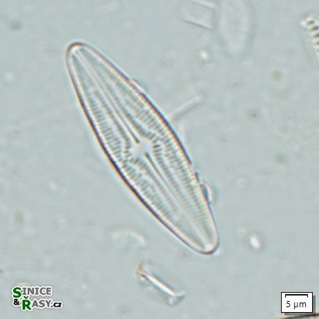Brachysira brebissonii