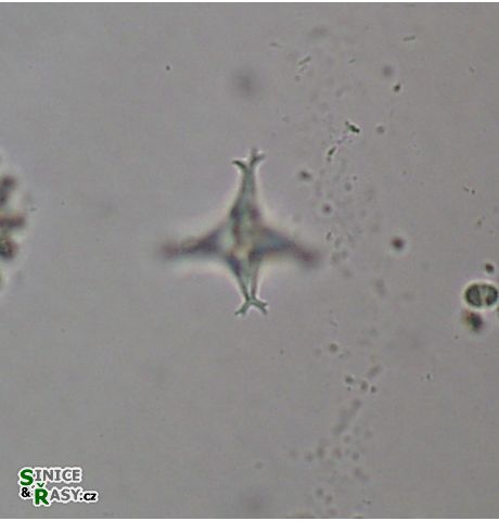 Pseudostaurastrum limneticum