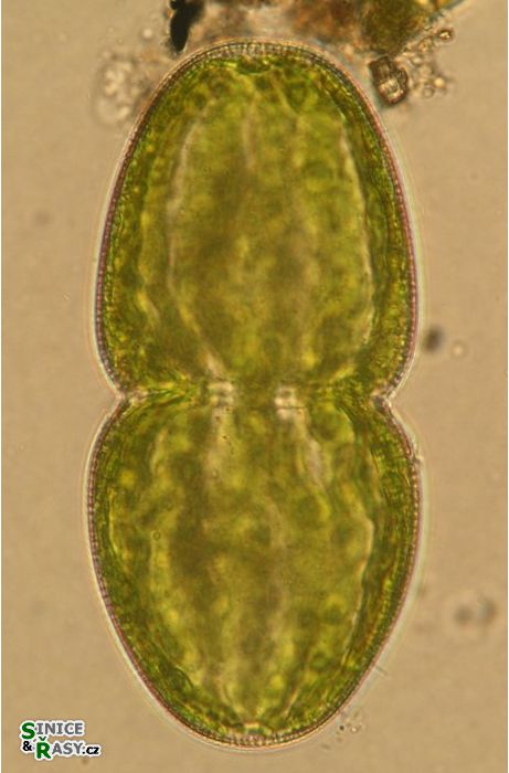 Actinotaenium turgidum