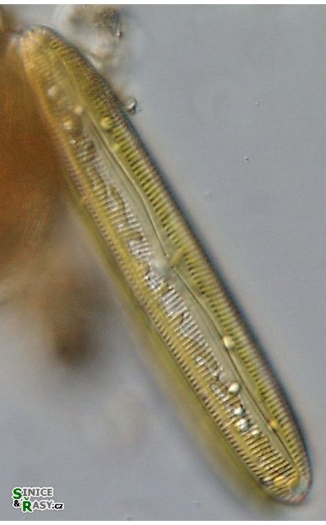 Pinnularia