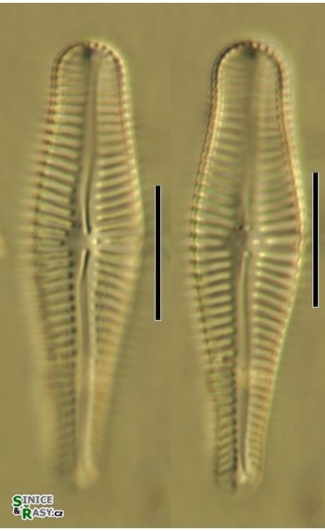 Gomphonema truncatum