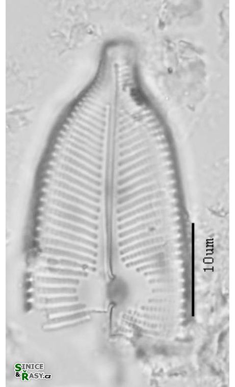 Cymbopleura cuspidata