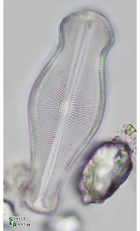 Didymosphenia geminata