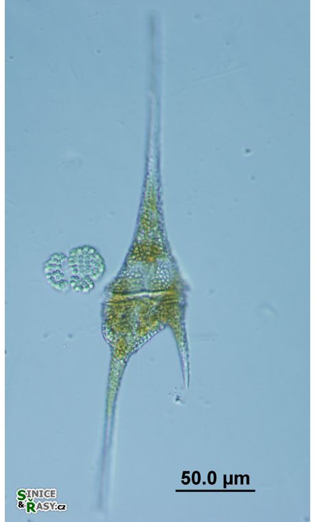 Ceratium furcoides