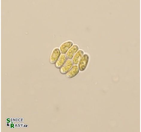 Scenedesmus obtusus var. disciformis