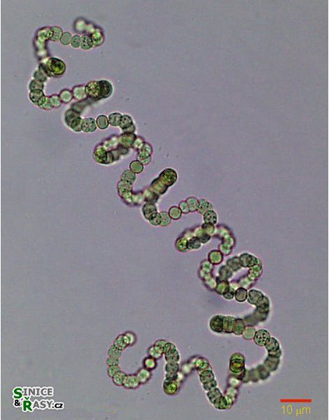 Dolichospermum spiroides