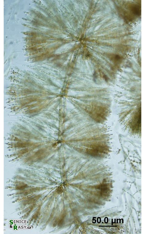 Batrachospermum gelatinosum