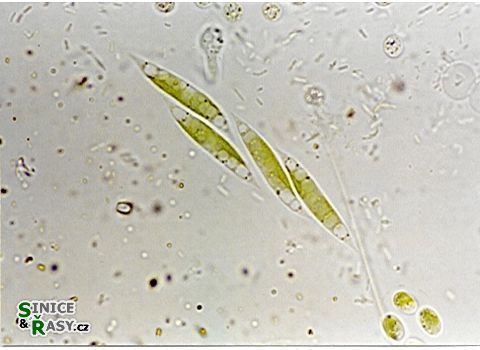 Elakatothrix spirochroma