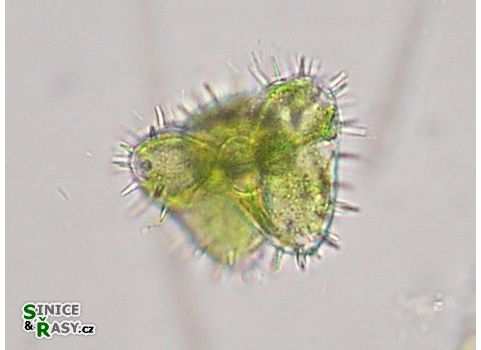Staurastrum teliferum