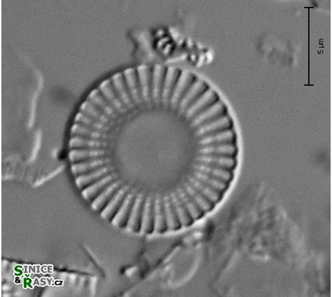 Cyclostephanos dubius