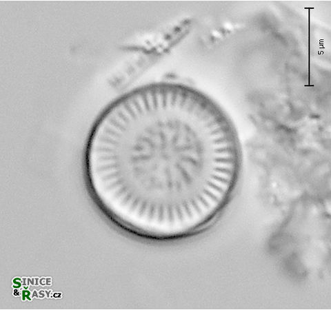 Discostella stelligera
