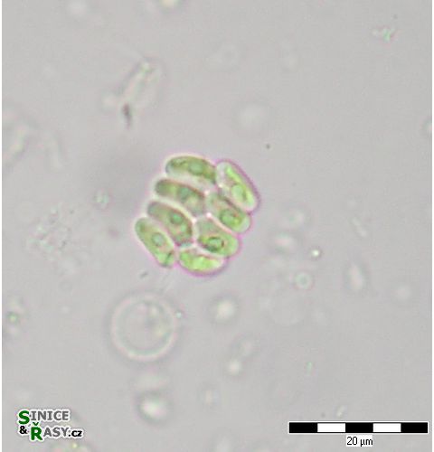 Scenedesmus cf. obtusus var. disciformis
