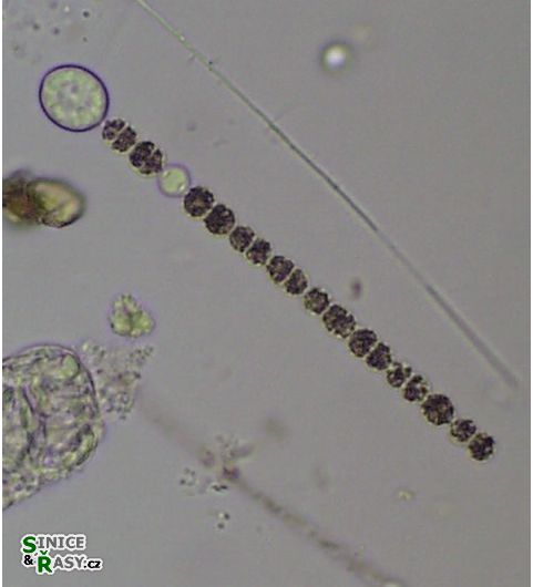 Dolichospermum