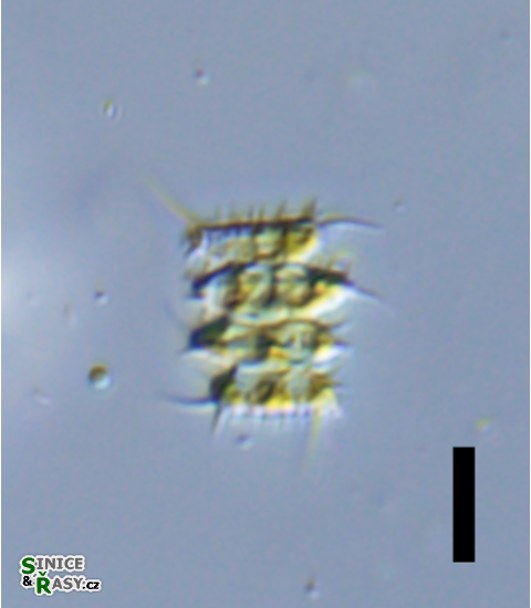 Desmodesmus lefevrei