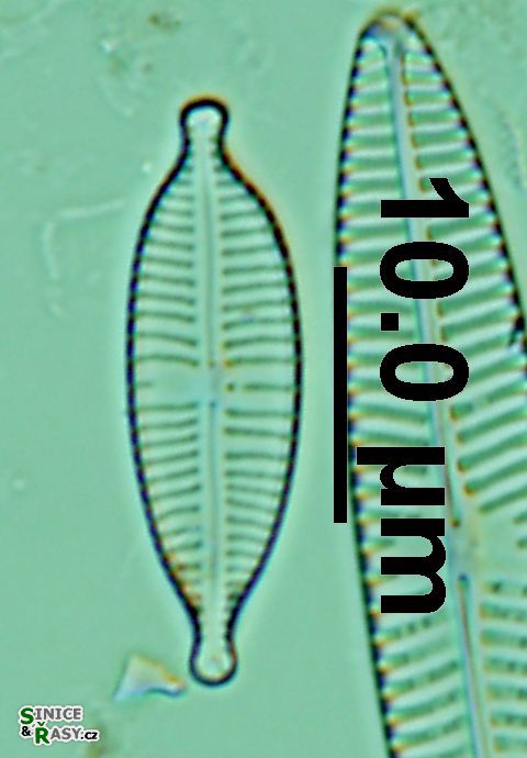 Gomphonema parvulum