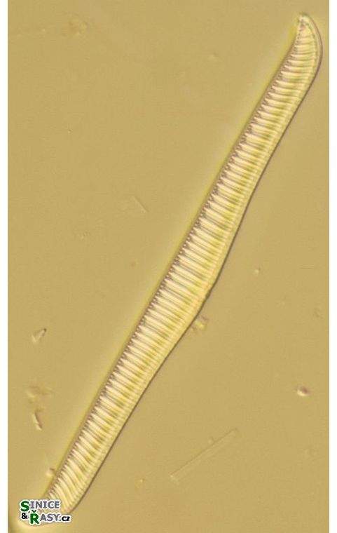 Rhopalodia gibba