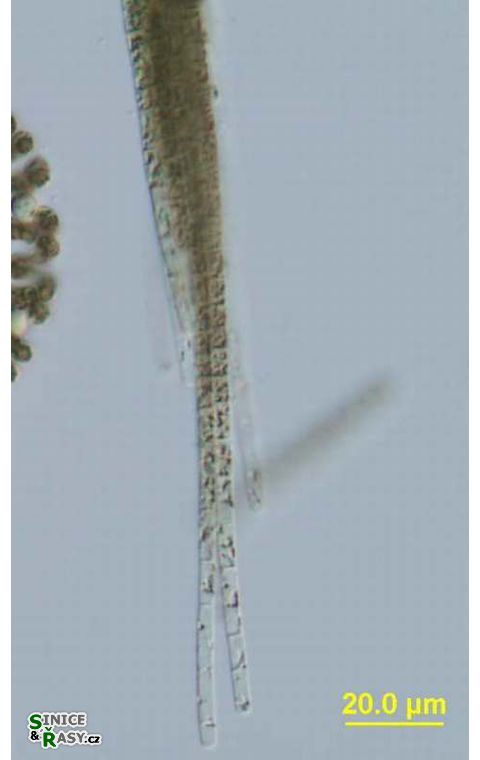 Aphanizomenon yezoense