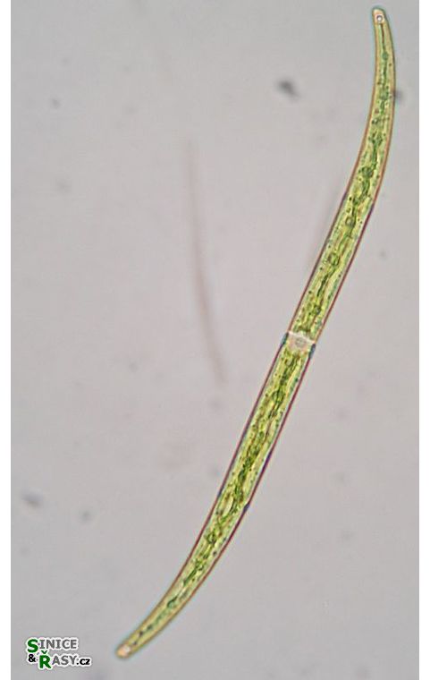 Closterium juncidum