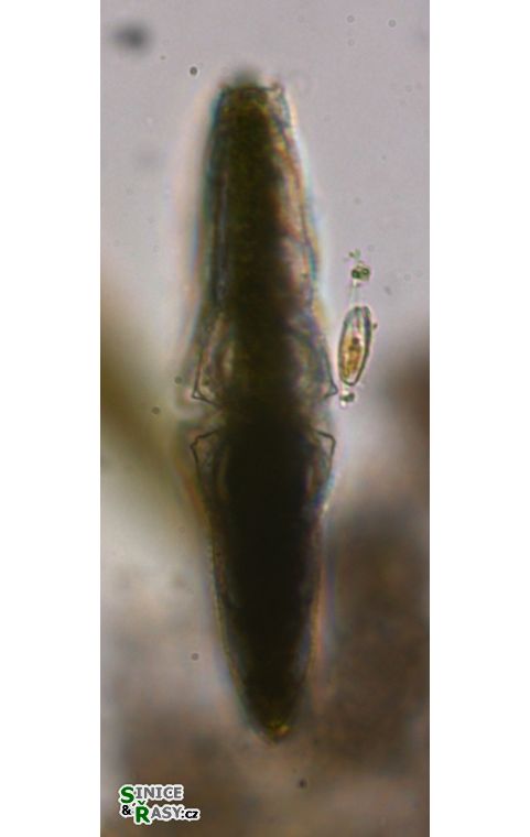 Micrasterias thomasiana
