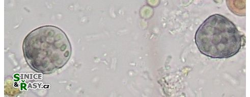 Gloeocapsa alpina