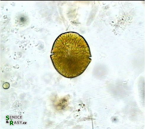Gymnodinium uberrimum