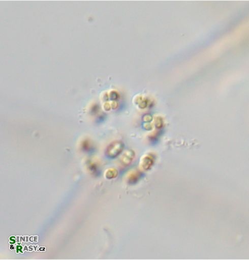Coelosphaerium kuetzingianum