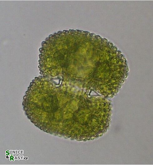 Cosmarium conspersum