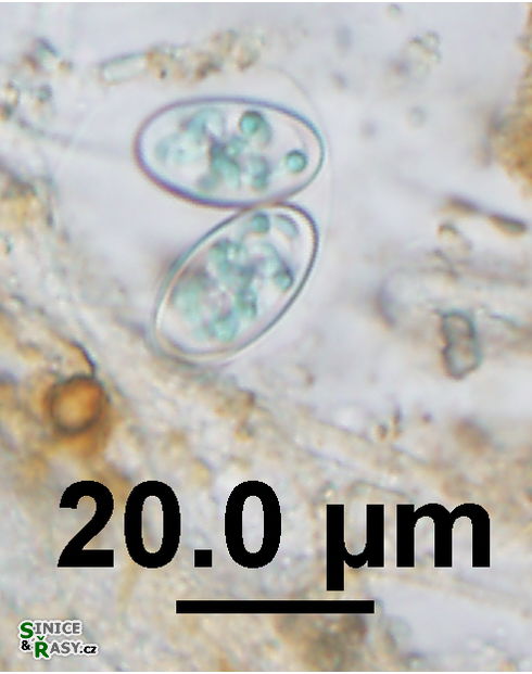 Glaucocystis nostochinearum