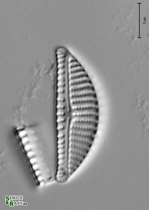 Encyonema ventricosum