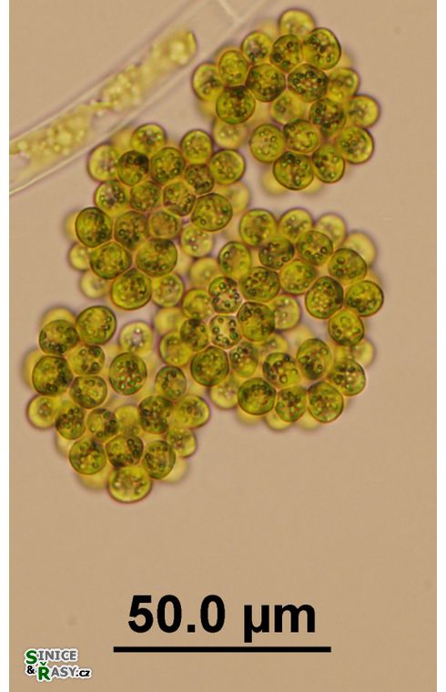 Botryosphaerella sudetica