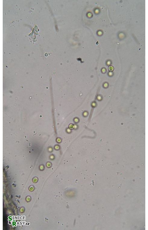 Palmodictyon viride